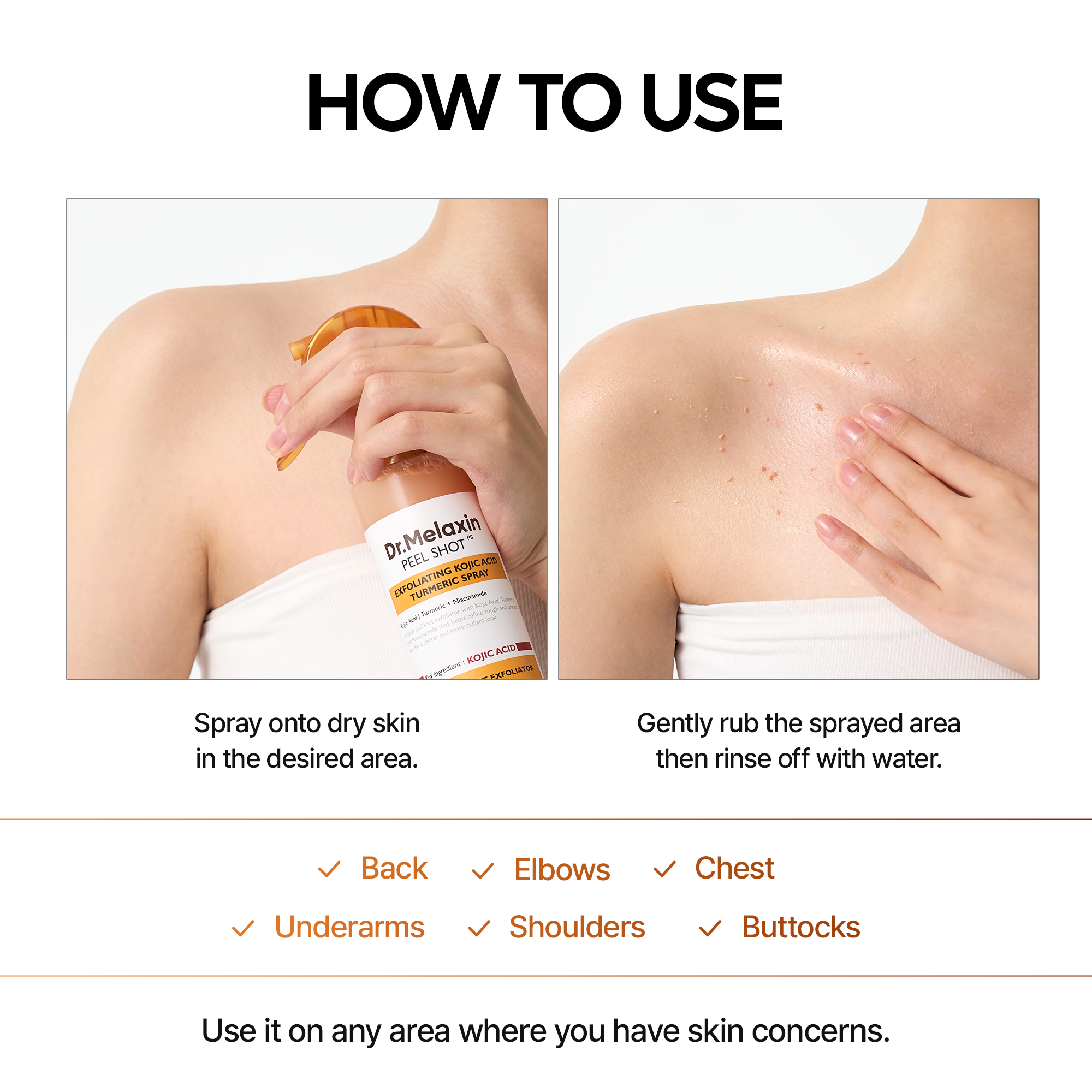Peel Shot Keratin Care Kojic Acid Turmeric Spray